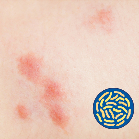 ผงโปรไบโอติกพรีเมียมของมนุษย์ลดการติดเชื้อสำหรับเด็กและทารก